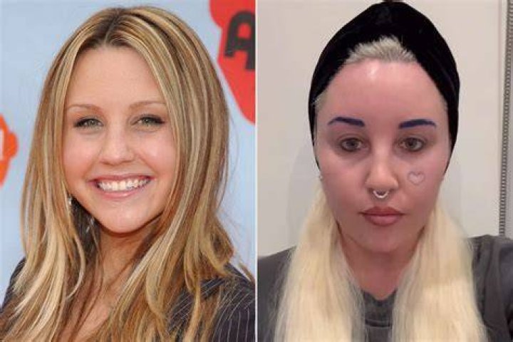 Amanda Bynes now Did she say Dan Schneider caused her breakdown