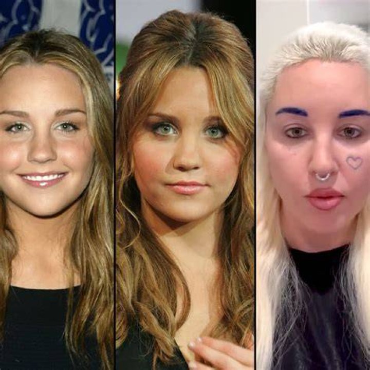Amanda Bynes Plastic Surgery Before And After Amandab vrogue.co