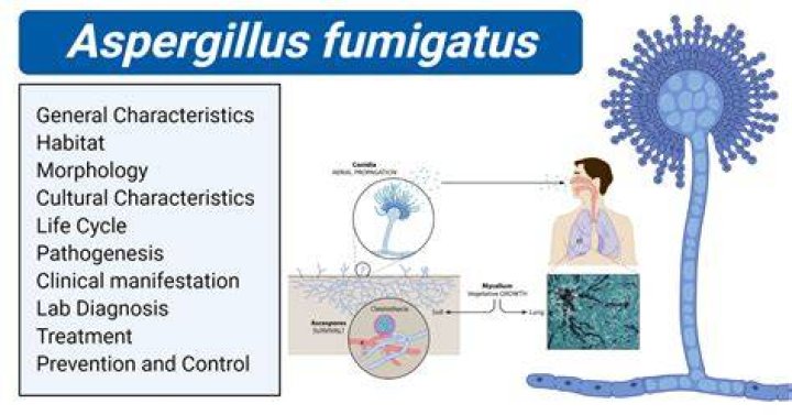 Aspergillus fumigatus Characteristics, Pathogenesis and Laboratory