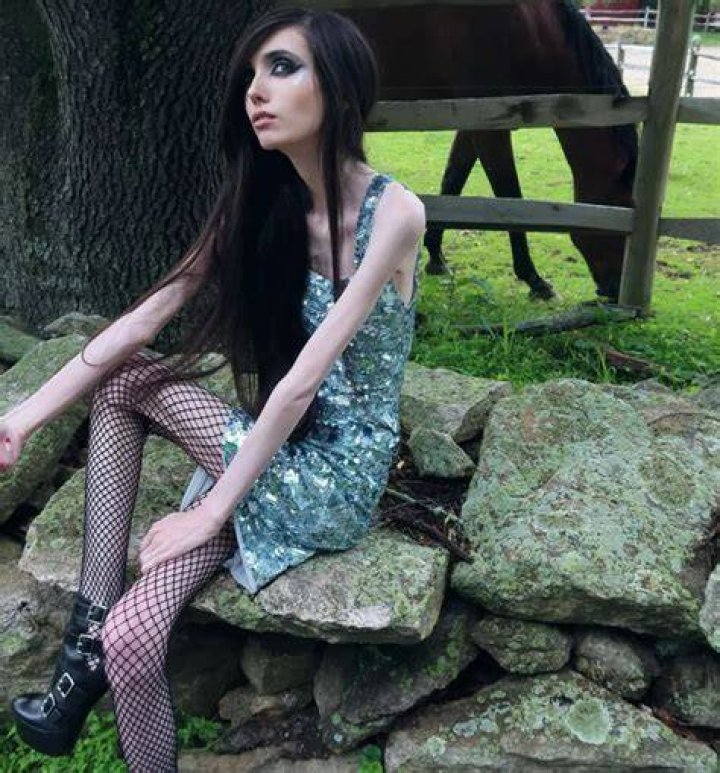 Cooney Eugenia Cooney Opens Up About Her Eating Disorder Cnn Video