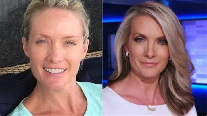 Dana Perino Plastic Surgery Facelift, Nose Job, Botox