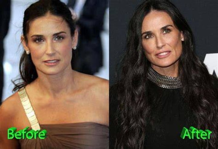 Demi Moore Plastic Surgery Rumor Or An Unrevealed Truth!