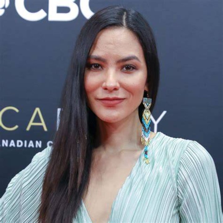 Did Jessica Matten Undergo Plastic Surgery Including Boob Job, Nose Job