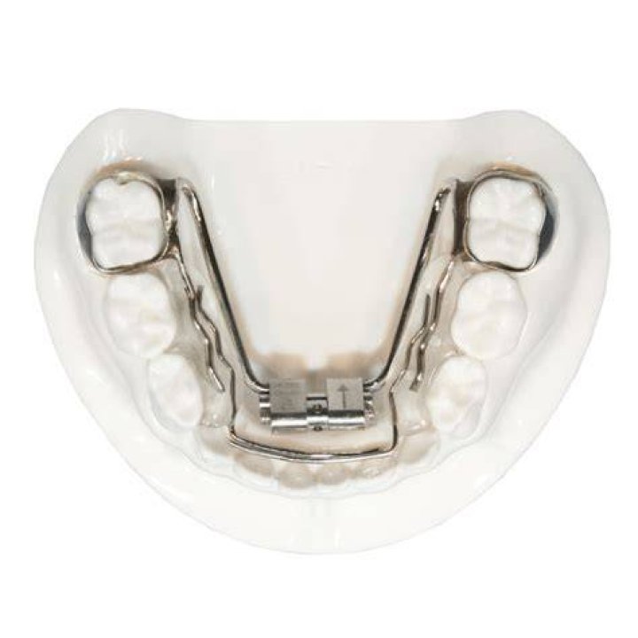 Expanders Five Star Orthodontic