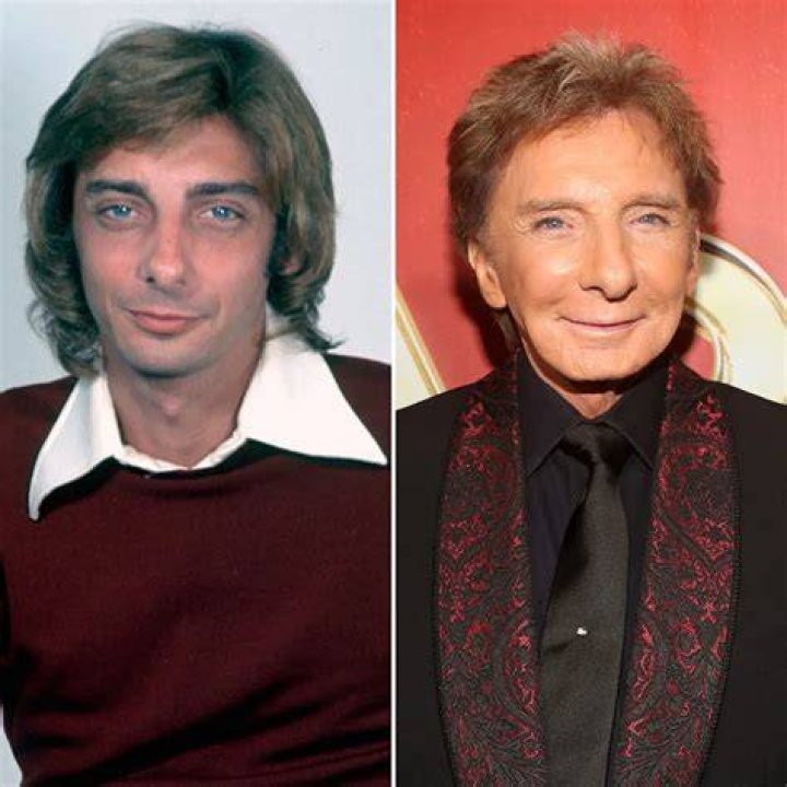 Has Barry Manilow Had Plastic Surgery? See the Singer's Transformation!