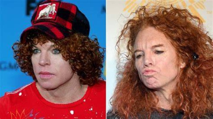 Has Carrot Top Had Plastic Surgery?