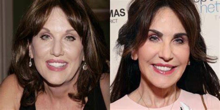 Has Robin McGraw Gotten Plastic Surgery?