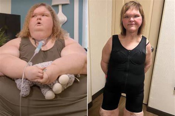 Is 1000Lb. Sisters&rsquo; Tammy Slaton Still Dating Greg Rumored
