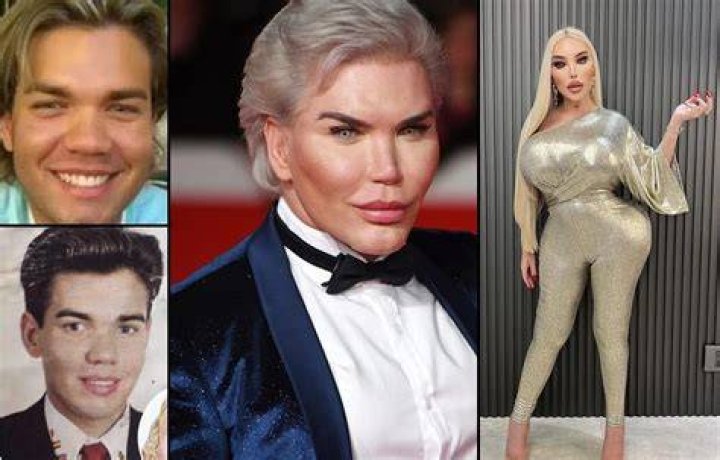 Jessica Alves Botched Human Ken Doll Is Back And Has A New Look Did