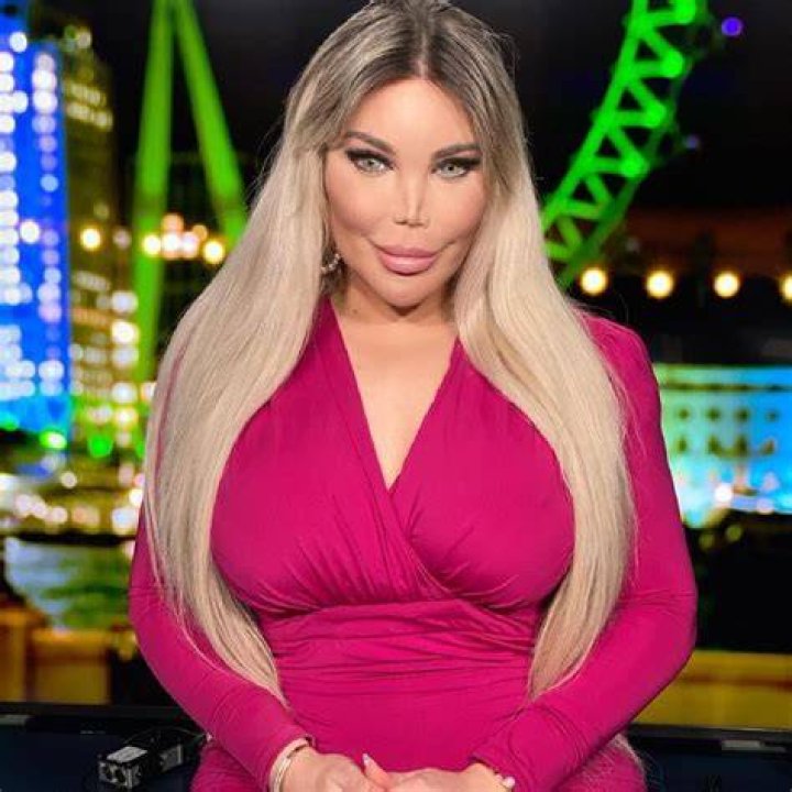 Jessica Alves, ennesima operazione per l'ex Ken Umano nel video spiega
