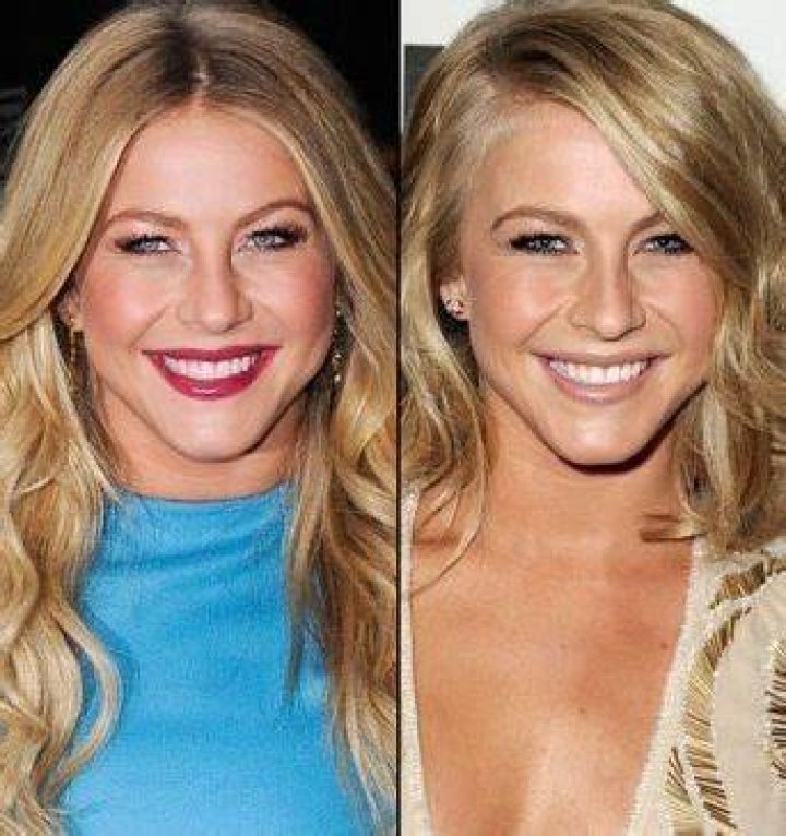 Julianne Hough Nose Job Before And After Photos