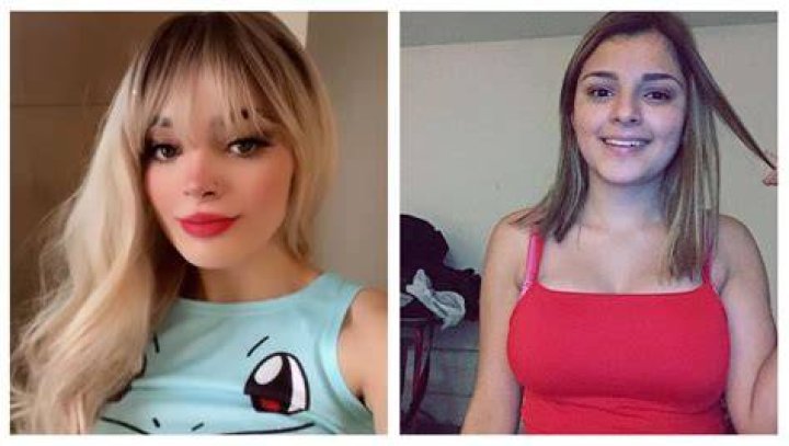 Karely Ruiz antes y despu&eacute;s de las cirug&iacute;as FOTOS