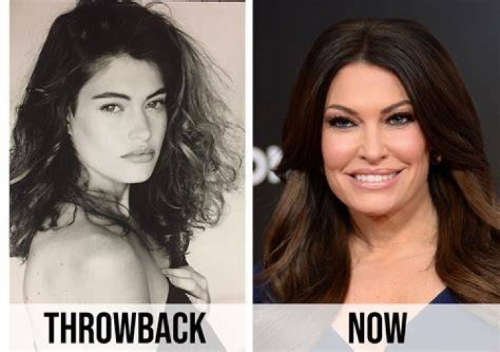 Kimberly Guilfoyle Before Surgery, Young Photos Age And Coza24 ☑️