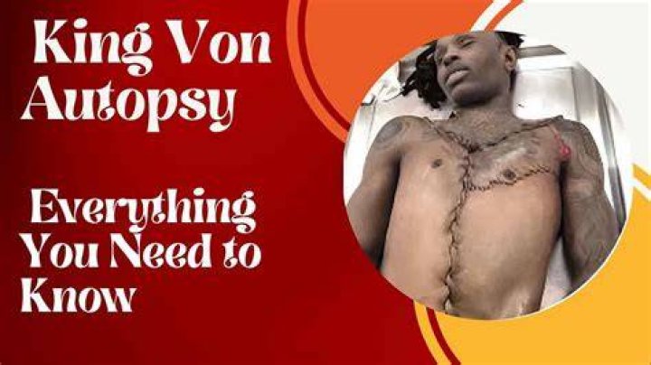 King Von Autopsy Report What Happened to Him on the Night of Death?