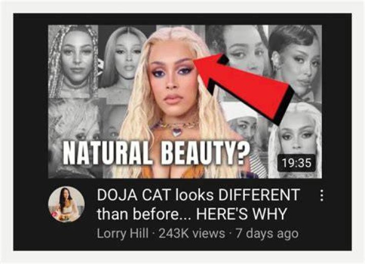 Lorry Hill Doja Cat Plastic Surgery Analysis (REUPLOADED) YouTube