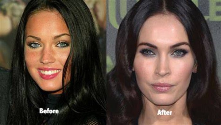 Megan Fox before and after plastic surgery boob job and lifting 2018