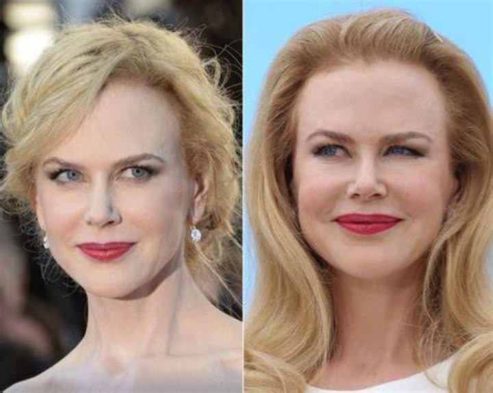 Nicole Kidman Before and After The Skincare Edit