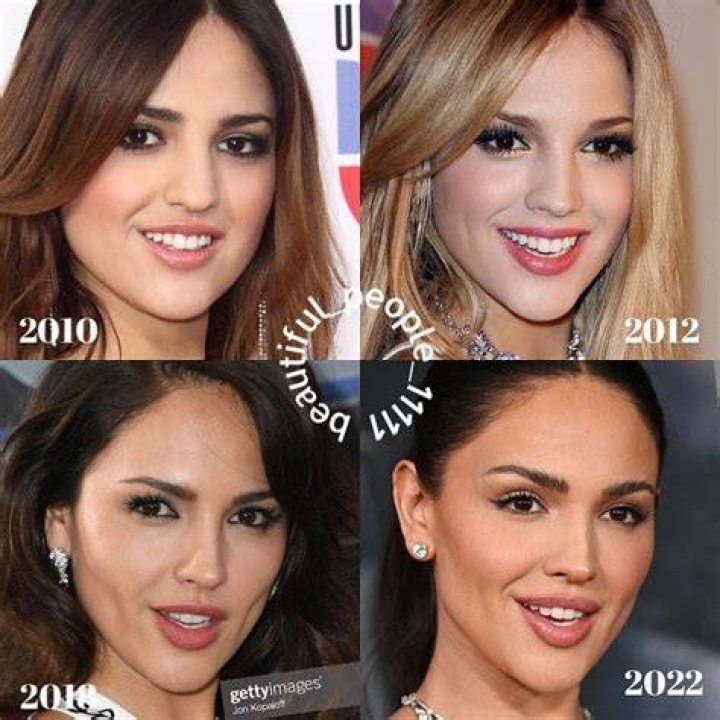 [PICS] Eiza Gonzalez&rsquo;s Plastic Surgery &mdash; She&rsquo;s Had More Than Nose Job