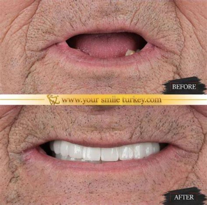 Pin on Before and After