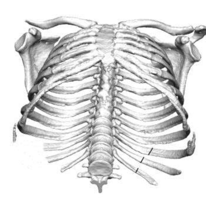 rib removal Archives