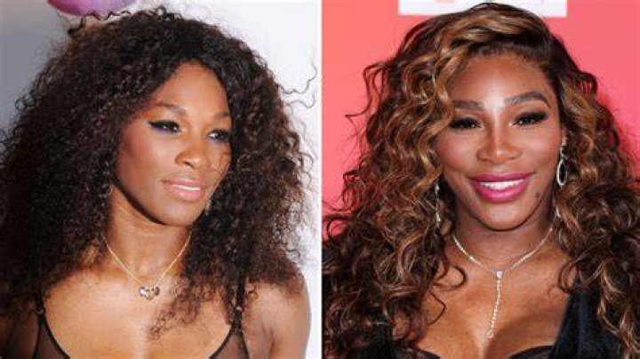 Serena Williams Plastic Surgery Before & After 2022