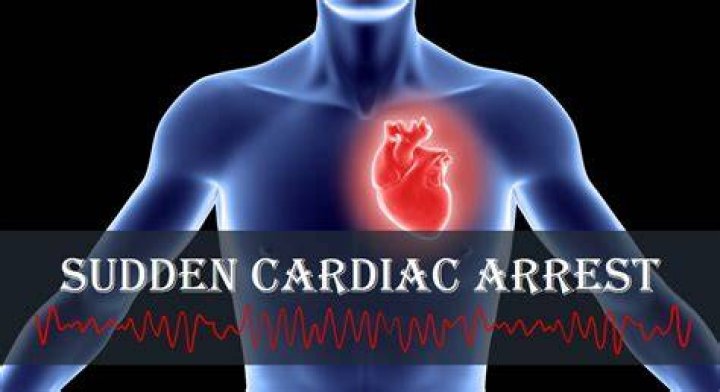 Sudden Cardiac Arrest and the Chain of Survival