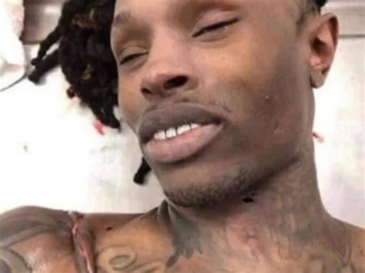 Witness The Tragic Aftermath: King Von Autopsy Photos [WARNING: Graphic]